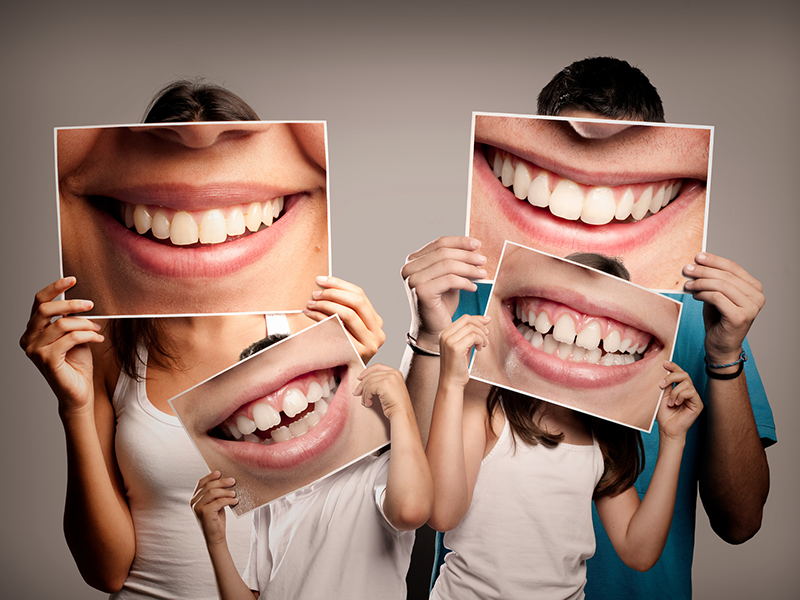 Family Dental Package in Lucknow