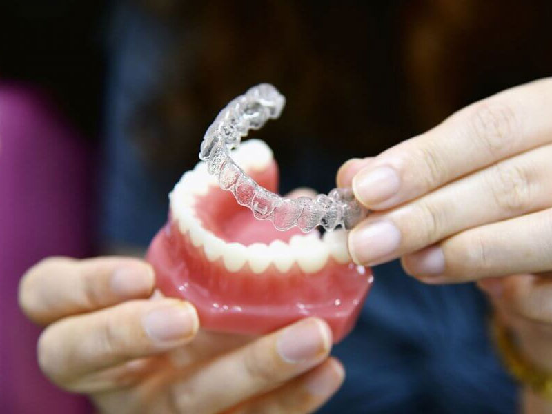 invisible braces cost in Lucknow