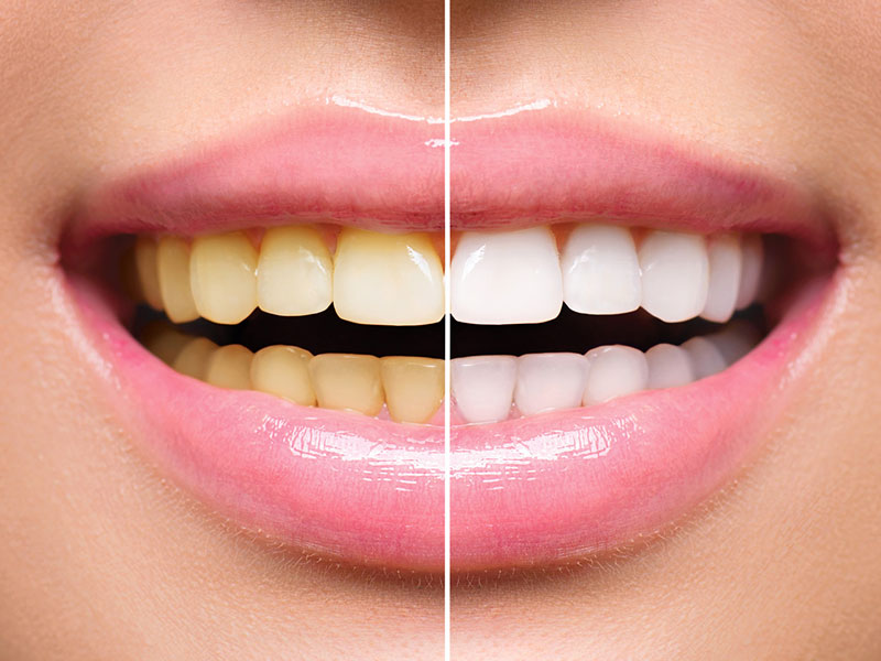 Best Orthodontic Clinic in Lucknow