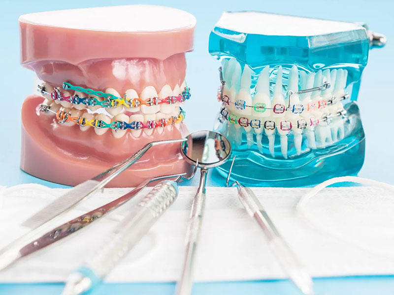 Orthodontist in Lucknow