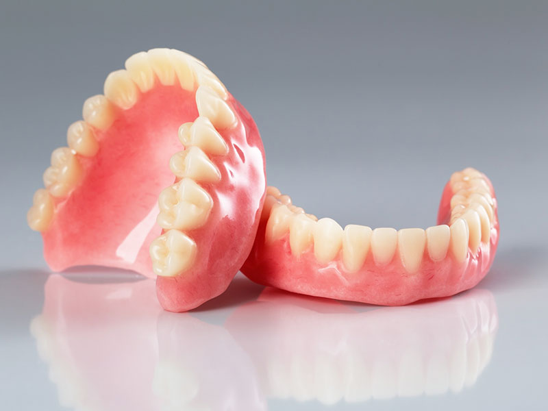 Best Dental Implants Clinic in Lucknow