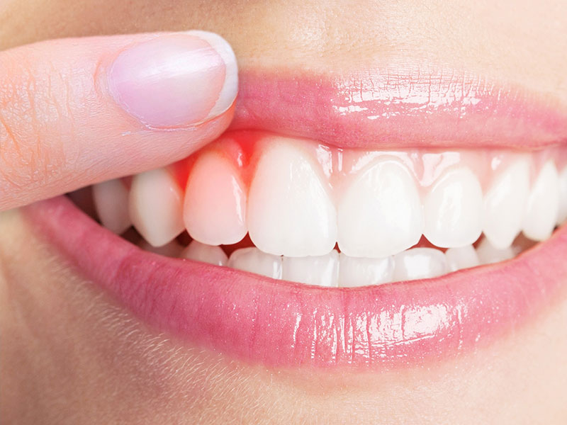 Best Periodontist in Lucknow